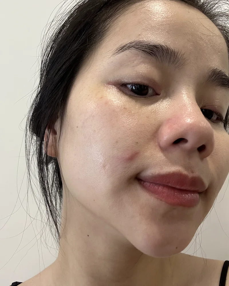 Ảnh cận cảnh da mặt mộc của Quin, thấy rõ các đốm nâu nhạt ở gò má